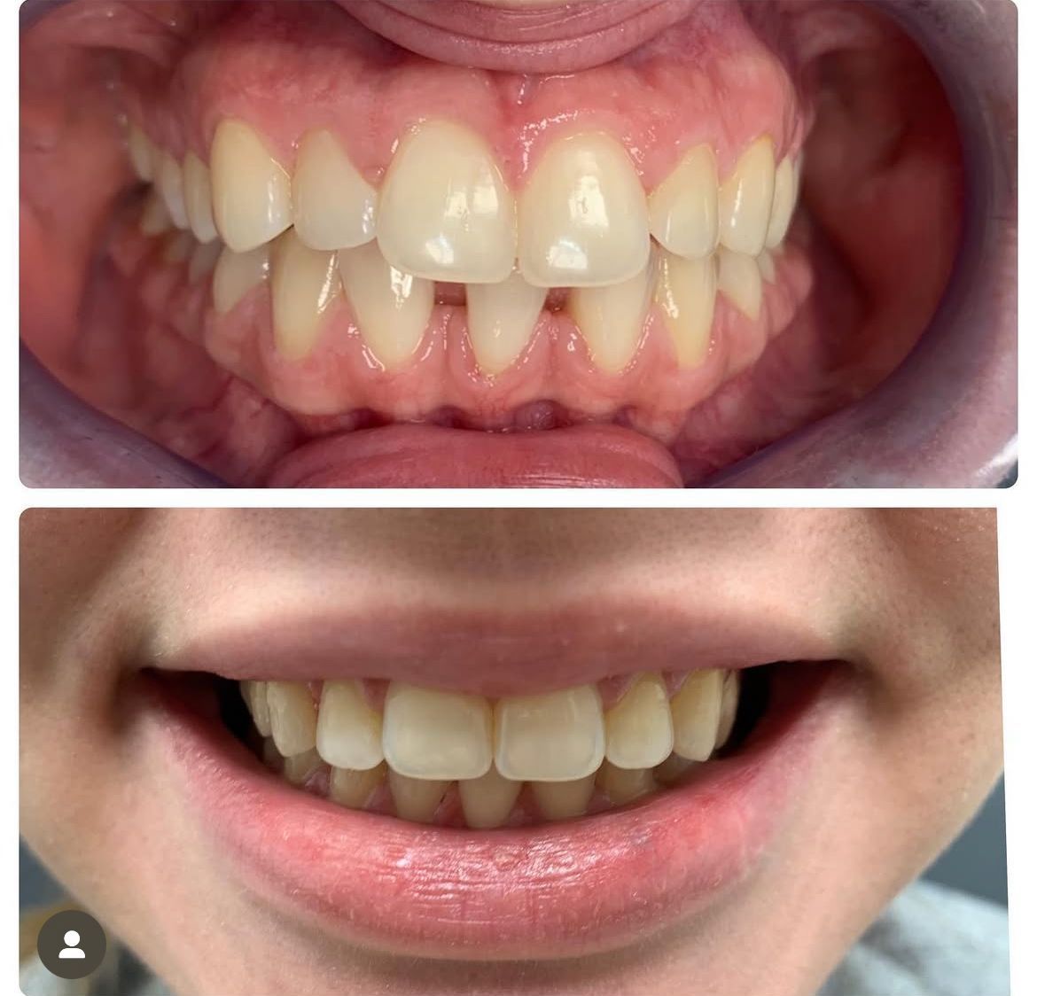 Oslo Invisalign-spesialist