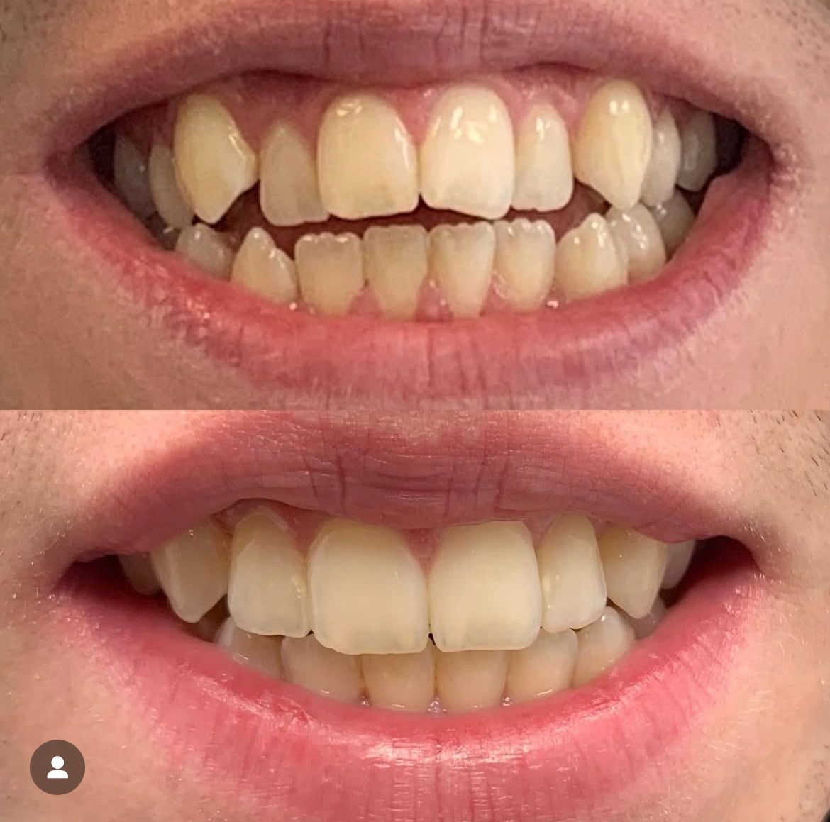 Gjennomsiktige Skinner Oslo