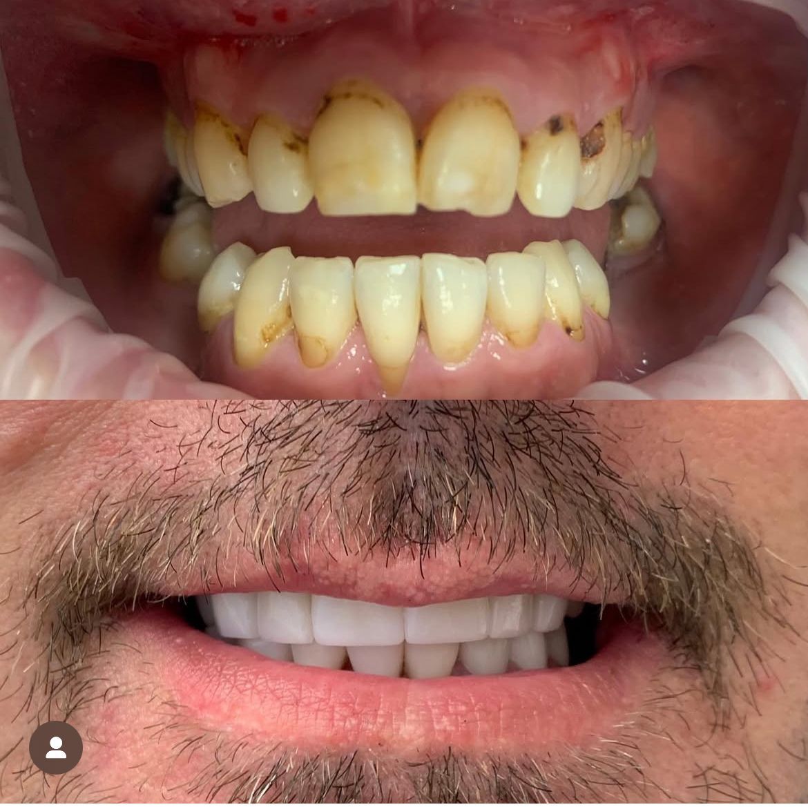 Ortodontisk Behandling Oslo