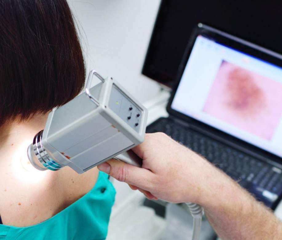 dermatoscopia