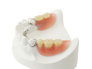 Removable — Removable Partial Dentures in Pinellas Park, FL
