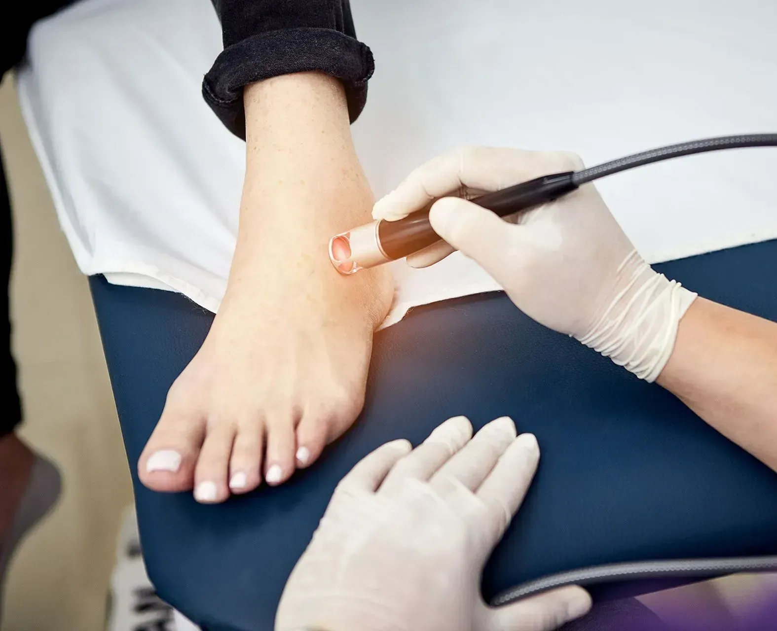 A medical professional in gloves uses a handheld laser device to treat a patient's foot on an exam table.