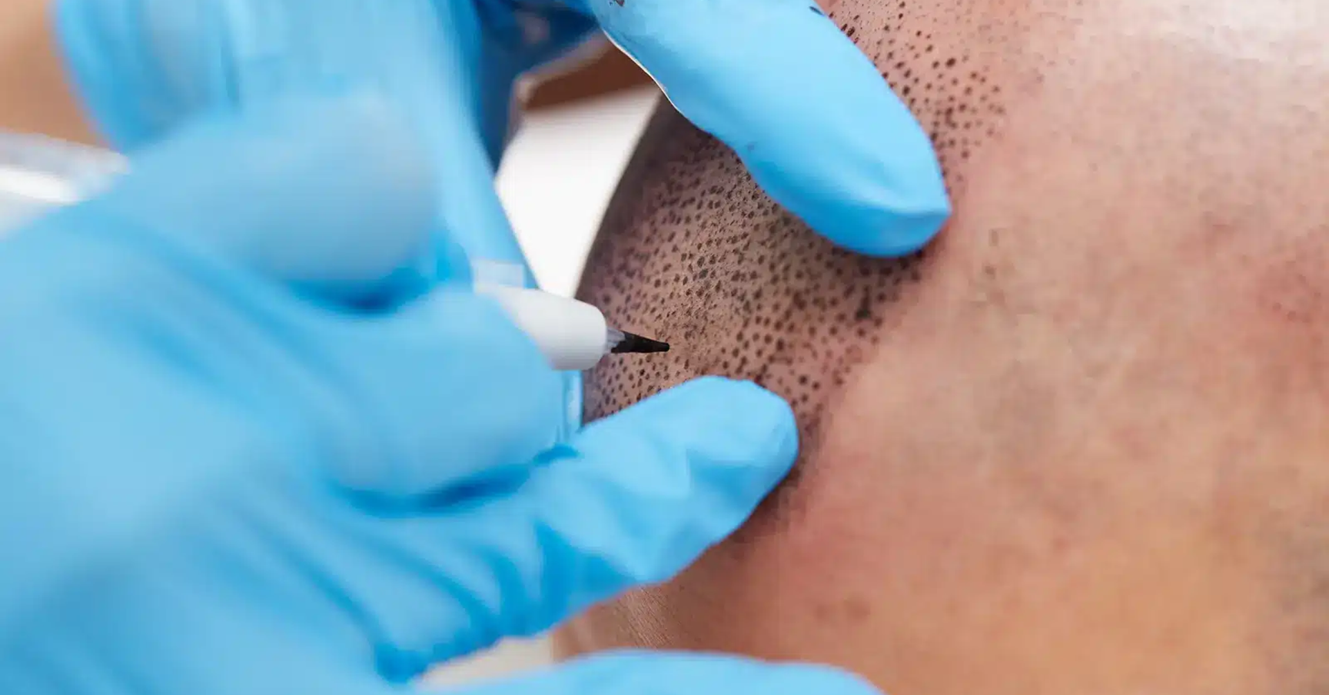 The Science of Staying True: How True Contour Prevents SMP Pigment ...