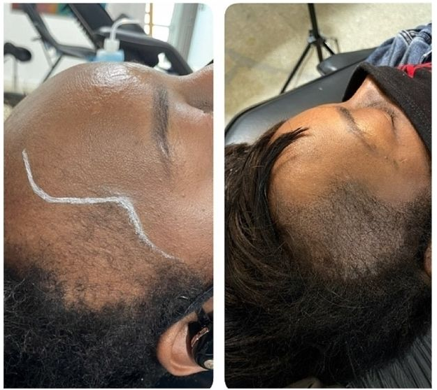 Areola tattoo Houston texas