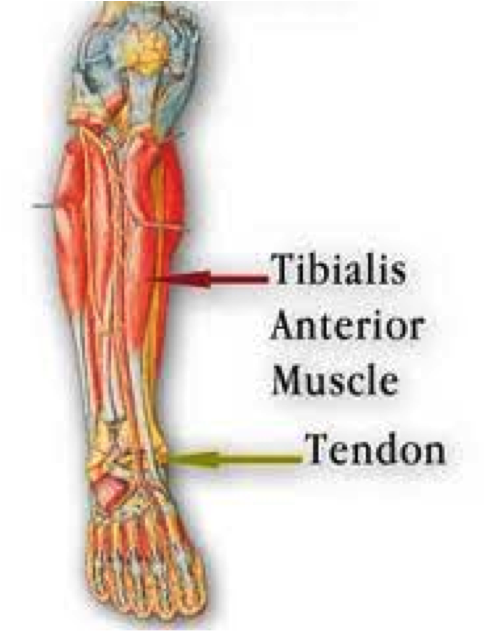 Tibialis Anterior Tendonitis