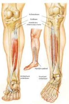 Shinsplints/beenvliesontsteking scheenbeenirritatie/tibiaal-stress-syndroom