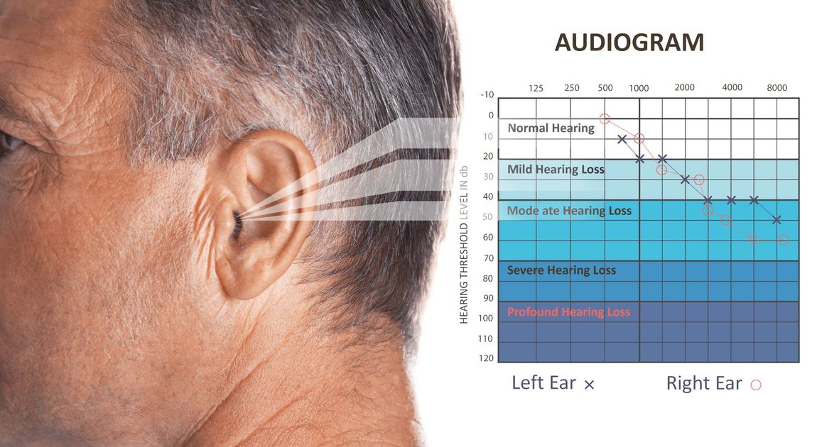 tabella per test dell'udito