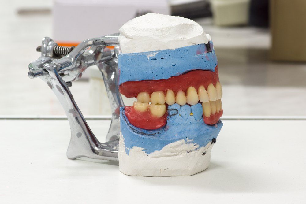A Dental Model of a Person 's Teeth is Sitting on a Table — Complete Denture Clinic in Wyong, NSW