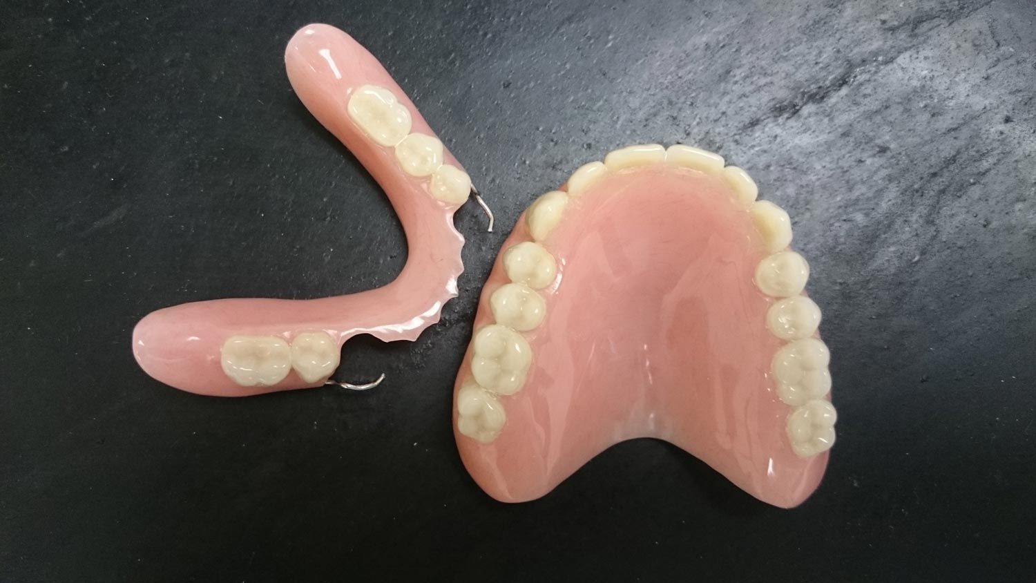 Partial And Full Dentures On A Table