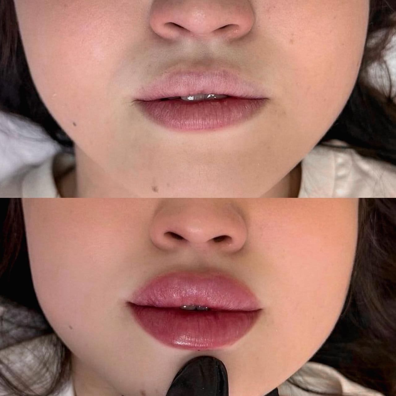 A before and after picture of a woman 's lips.