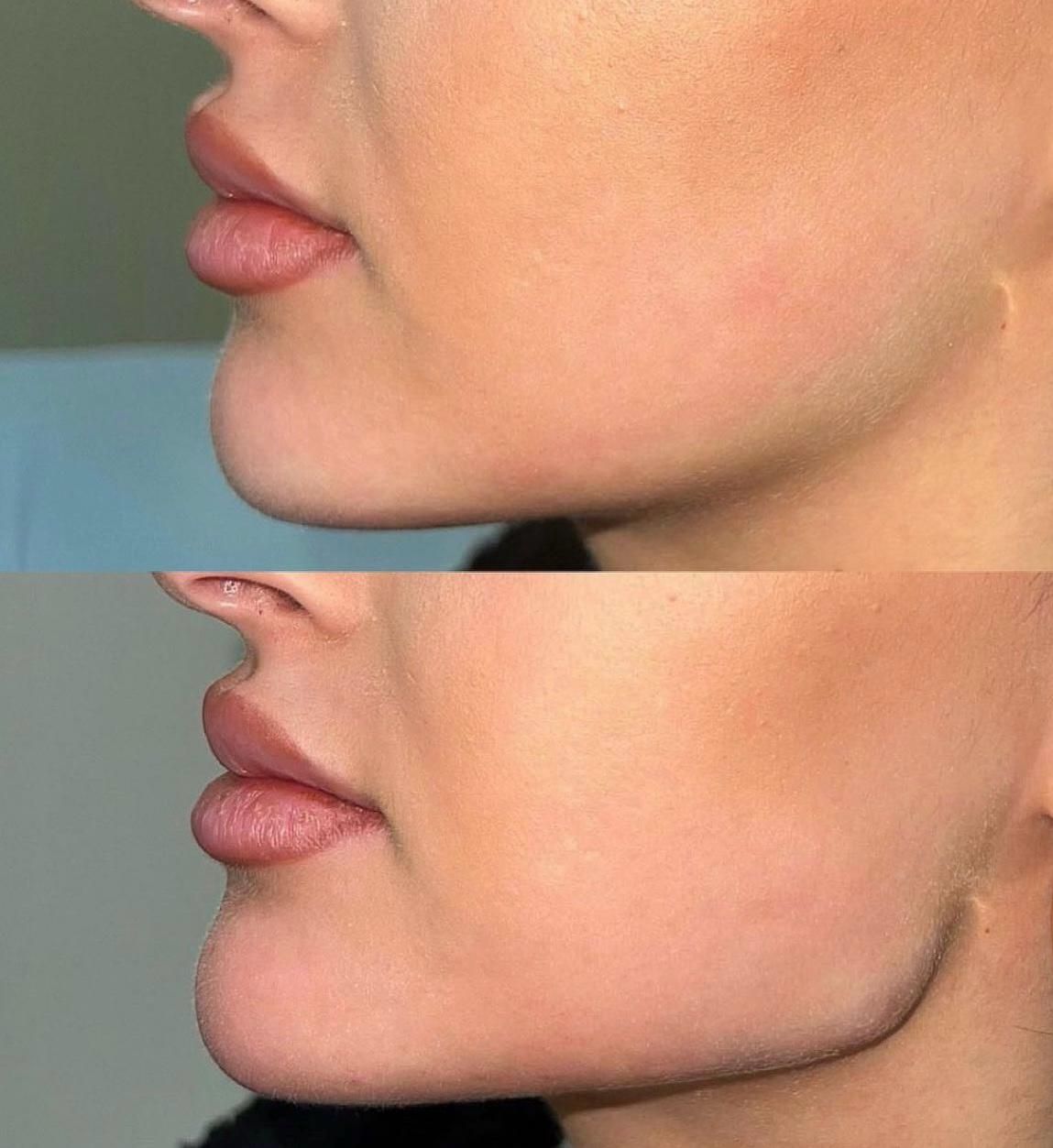 A woman is getting her hair dyed in a salon.