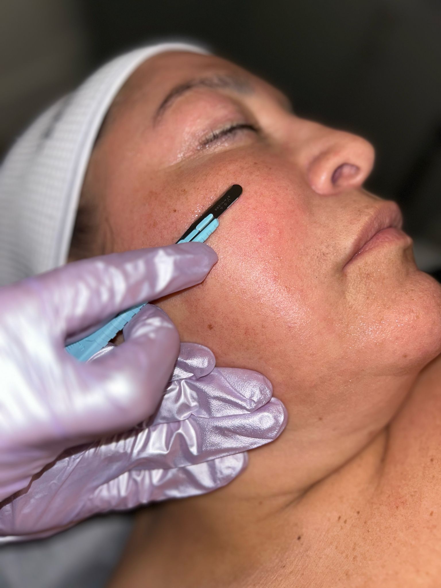A woman is getting a facial treatment with a razor.