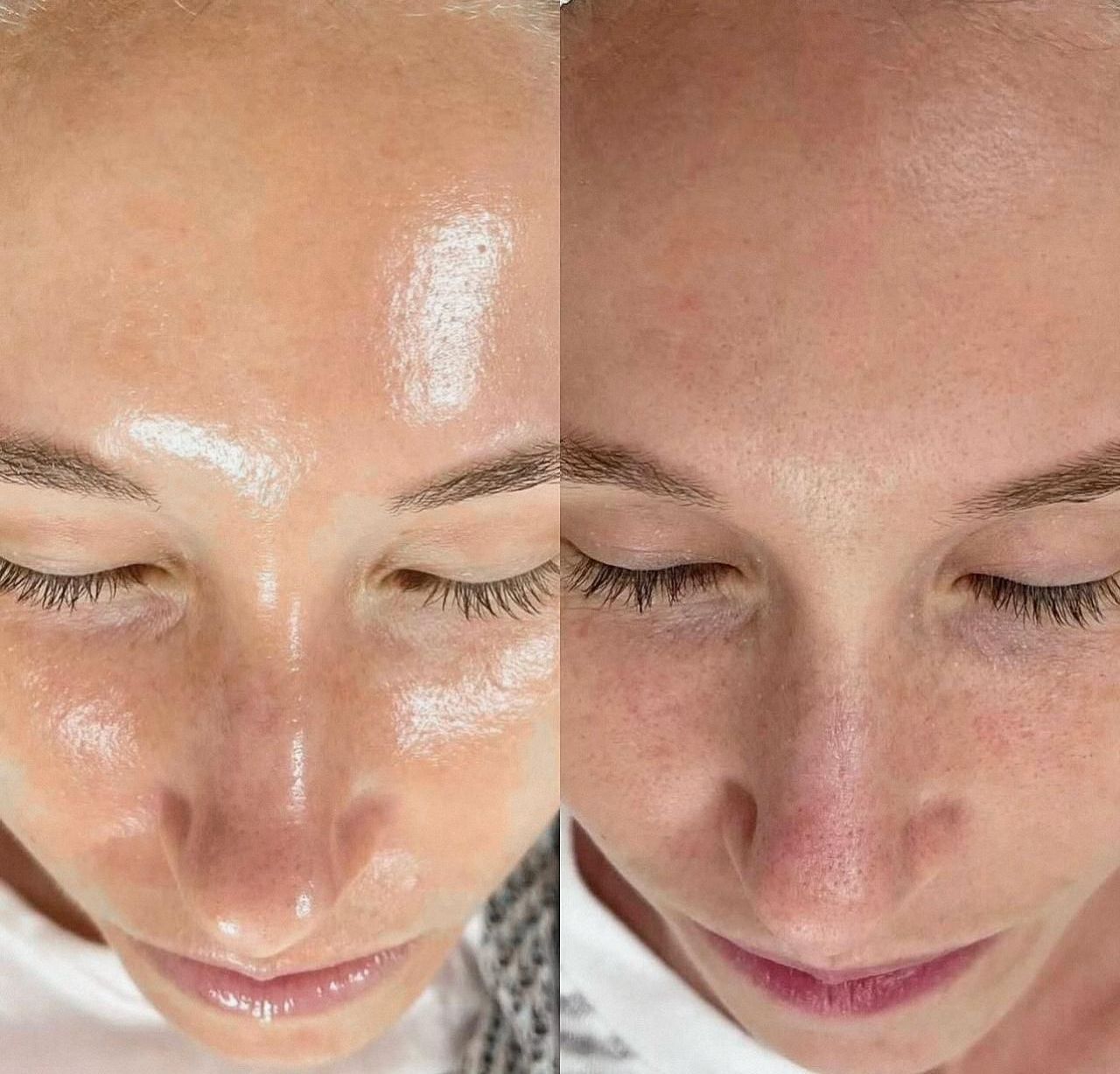 A before and after picture of a woman 's face with her eyes closed.