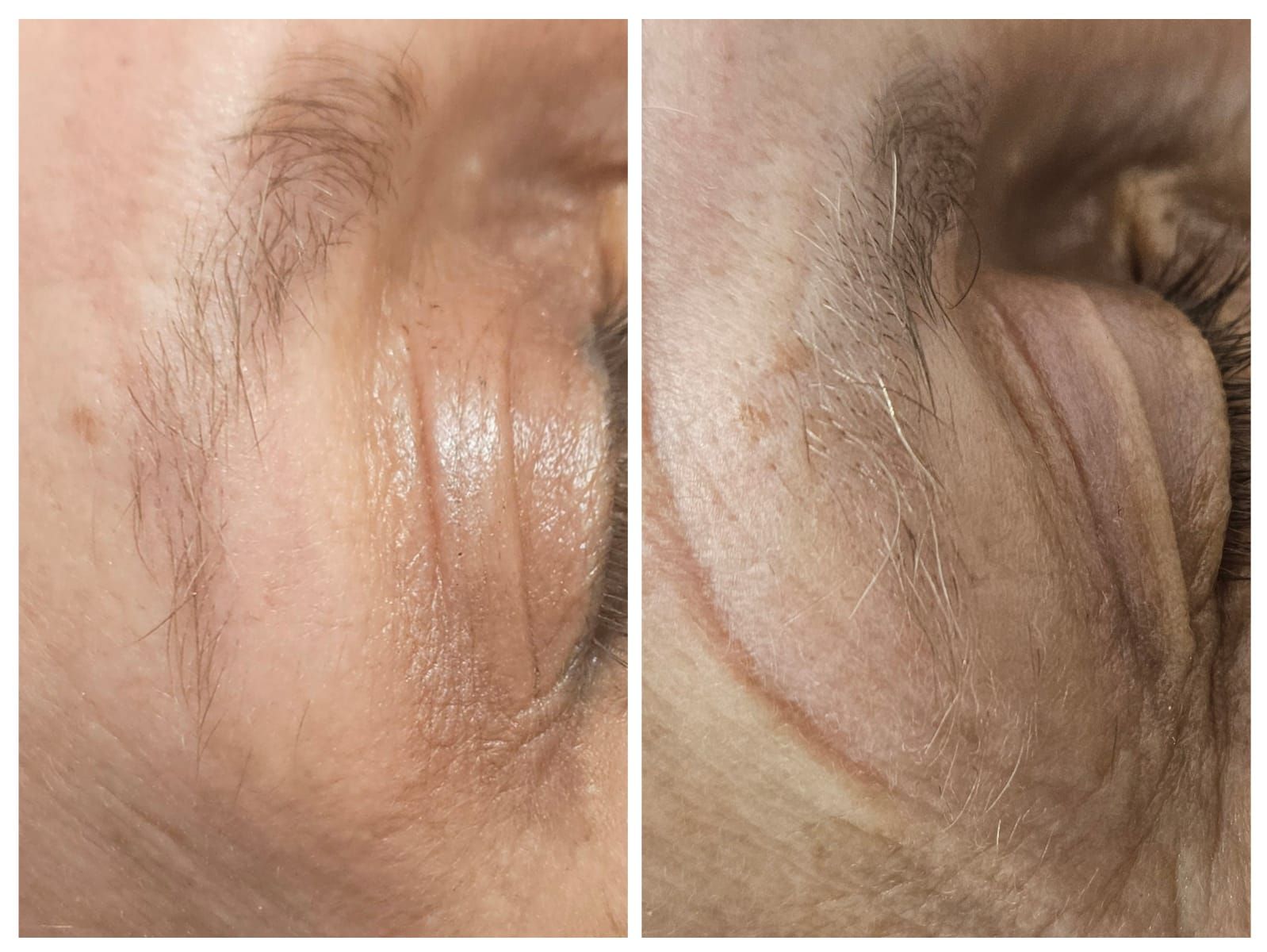 A before and after photo of a woman 's face.