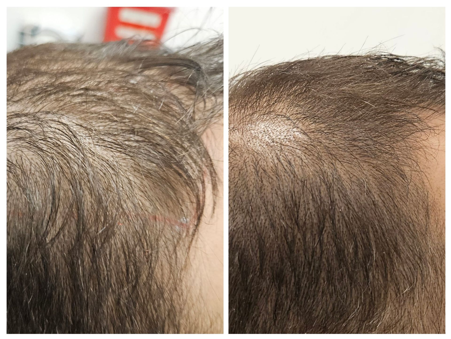 A before and after photo of a person 's hair.