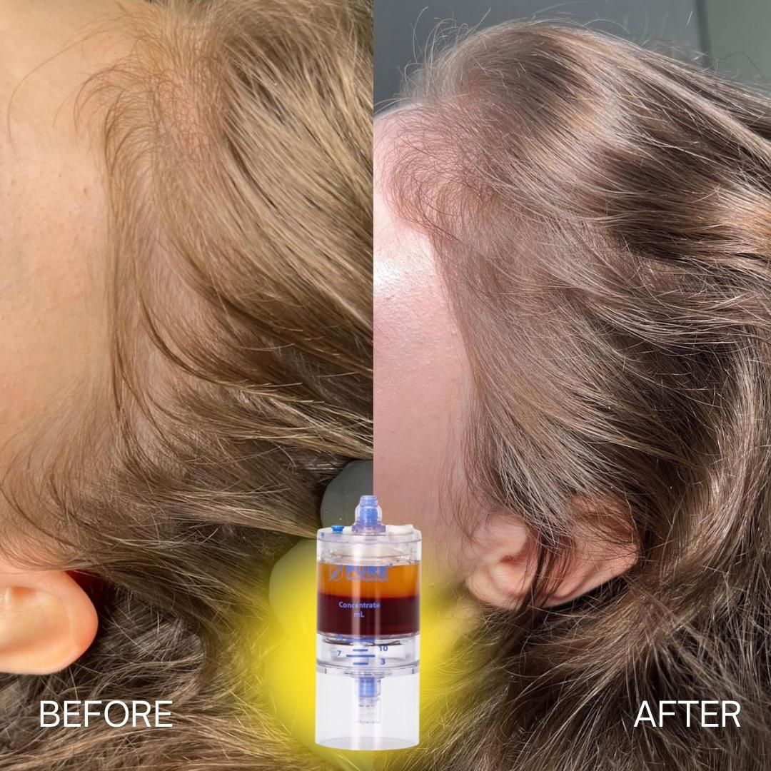 A before and after photo of a person 's hair