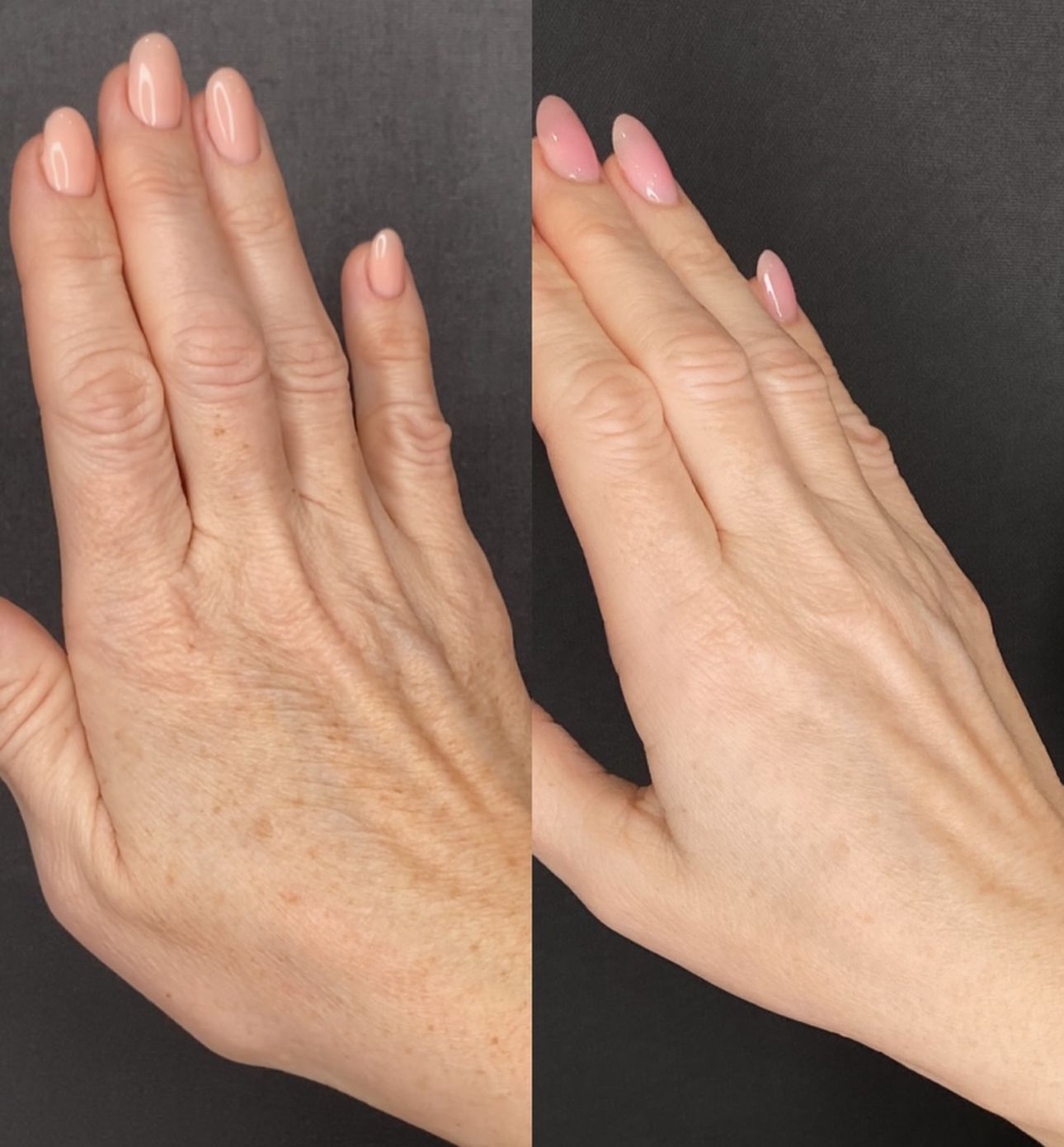 A before and after photo of a woman 's hands