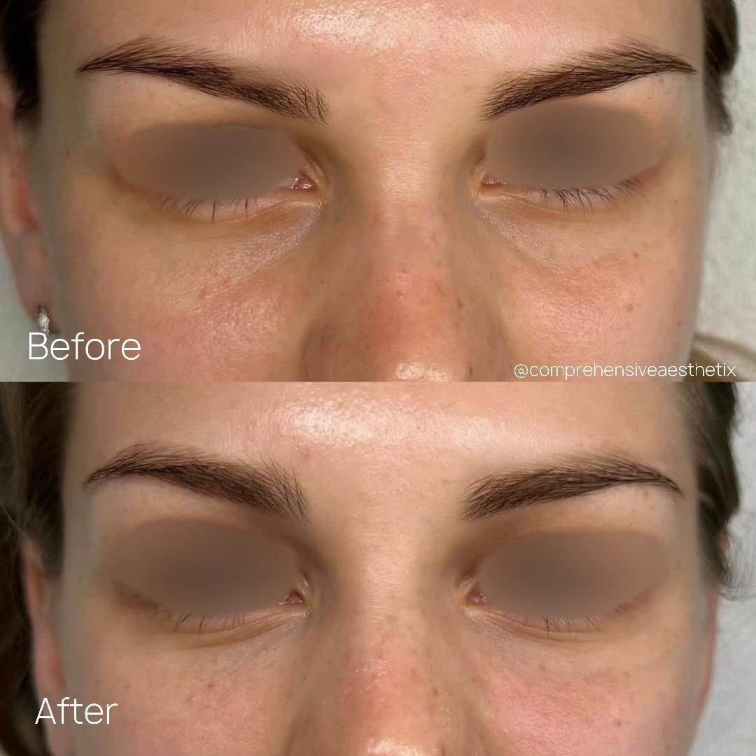 A before and after photo of a woman 's face with her eyes closed.