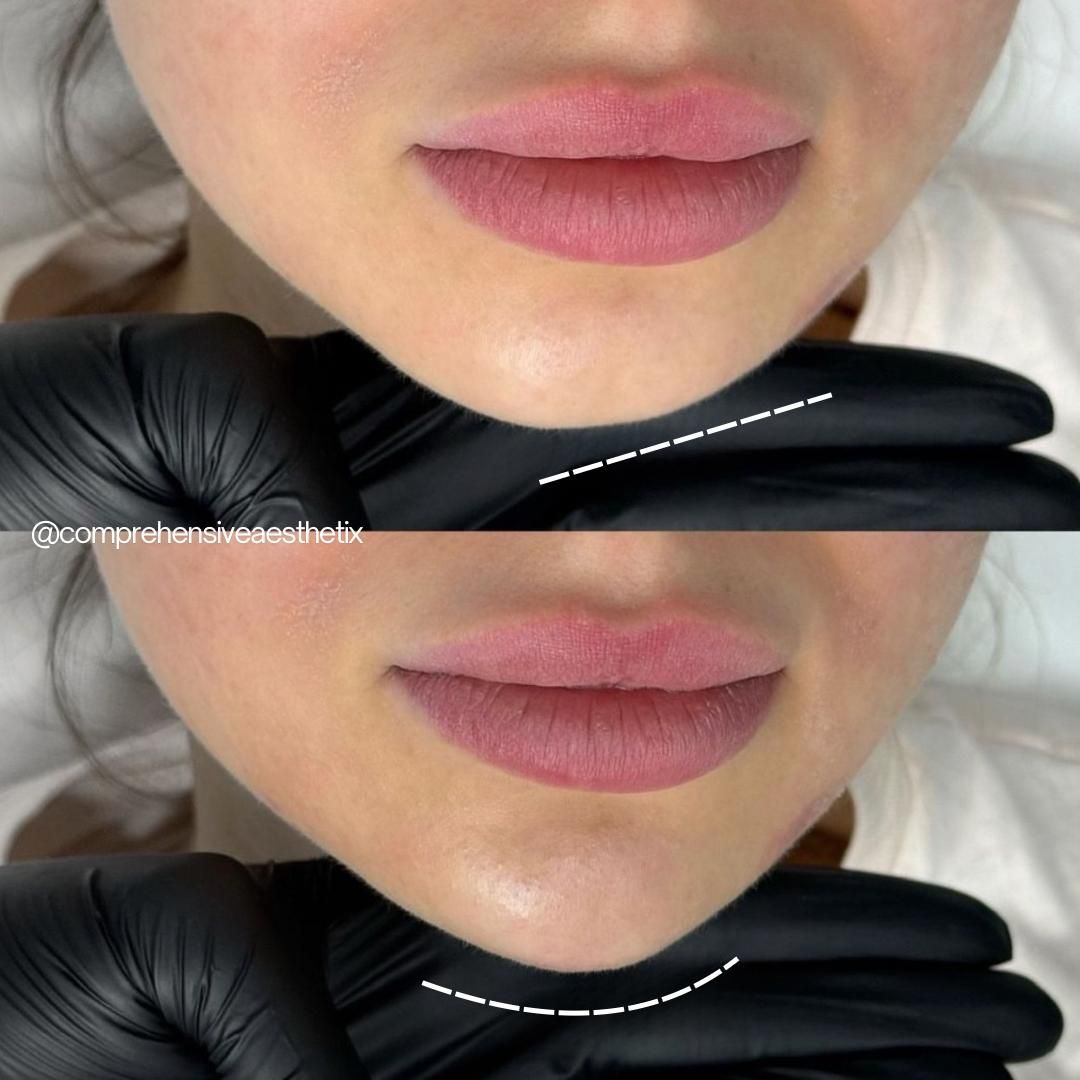 A before and after photo of a woman 's lips with black gloves