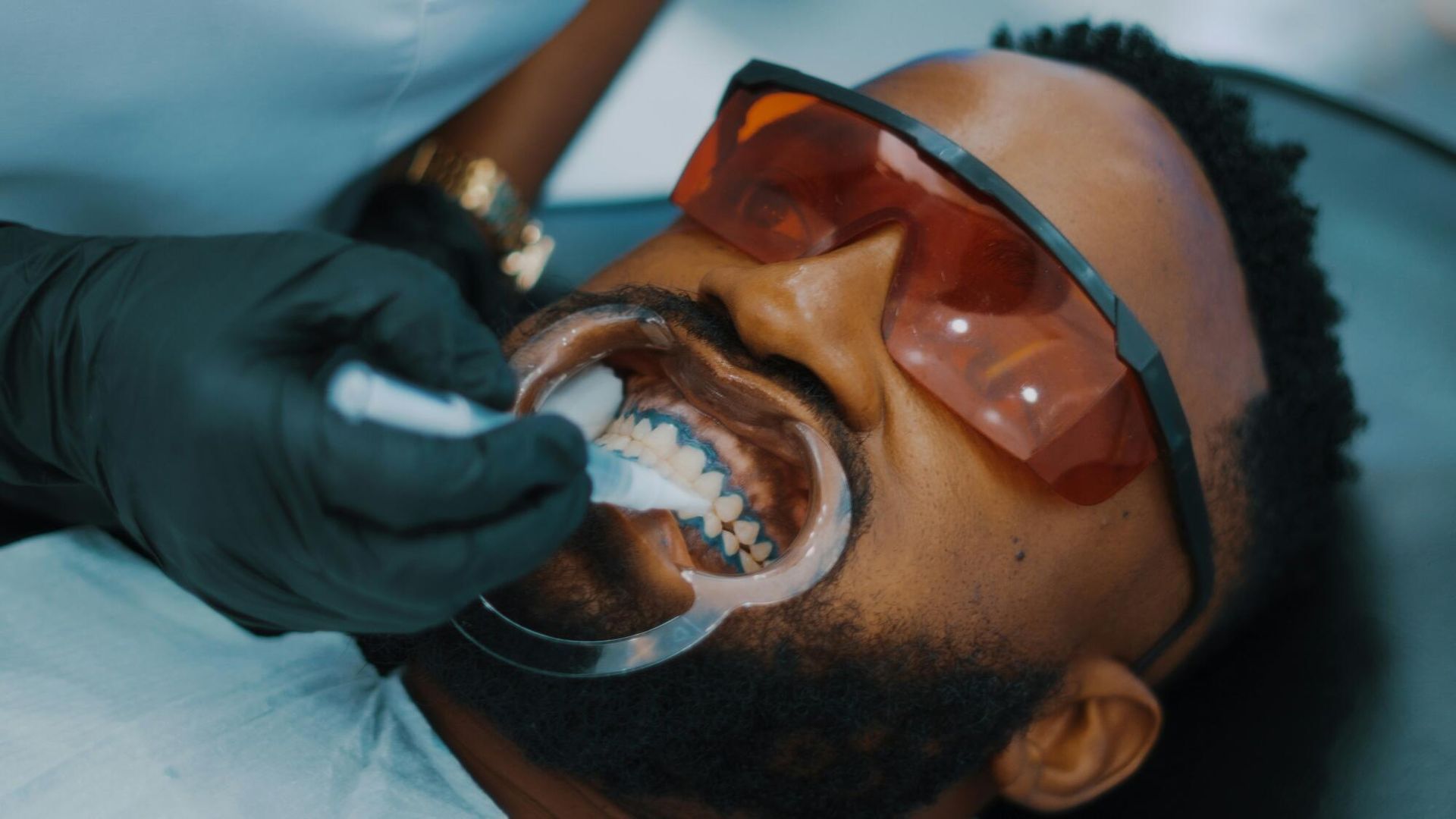 Man getting teeth whitened at the dentist; black gloved hand holding a whitening applicator.