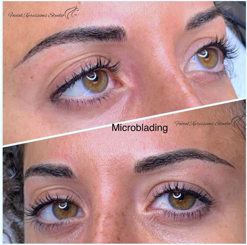 A woman 's eyebrows before and after microblading