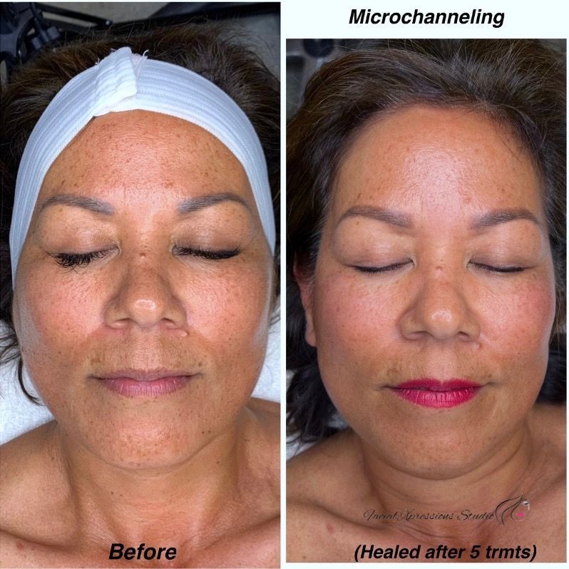 A before and after photo of a woman 's face