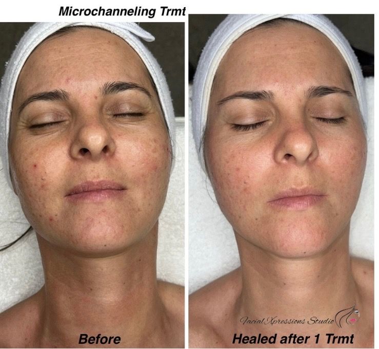A before and after photo of a woman 's face