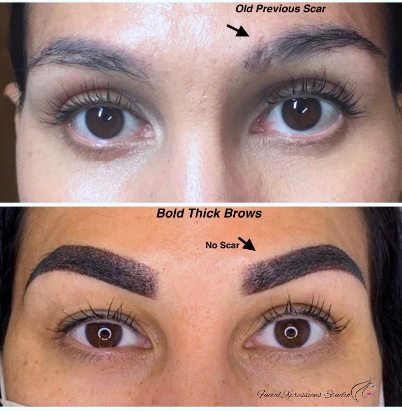 A before and after picture of a woman 's eyebrows