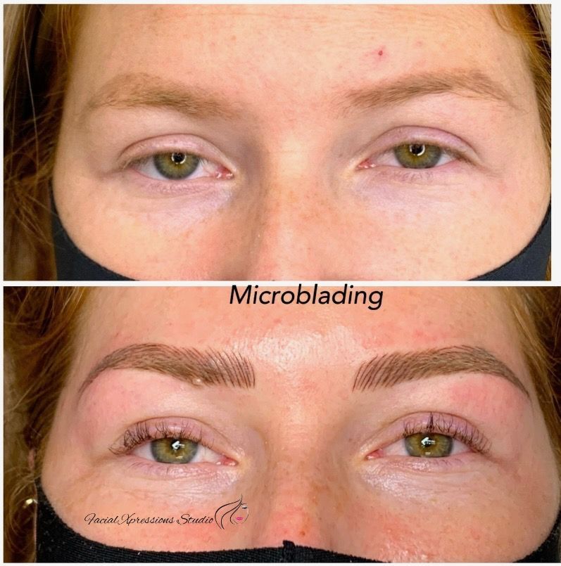 A woman 's eyebrows before and after microblading