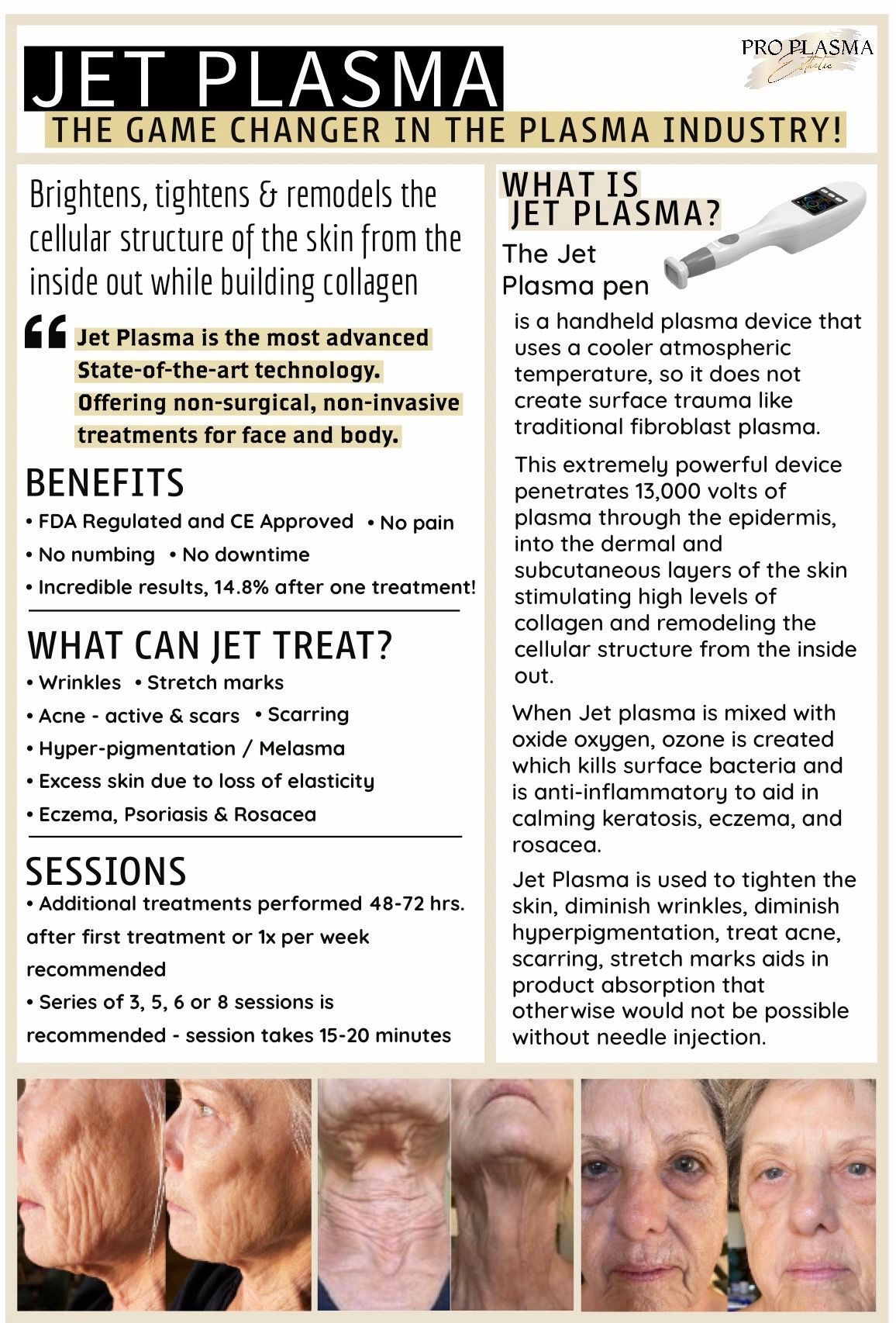 Jet plasma is the game changer in the plasma industry !