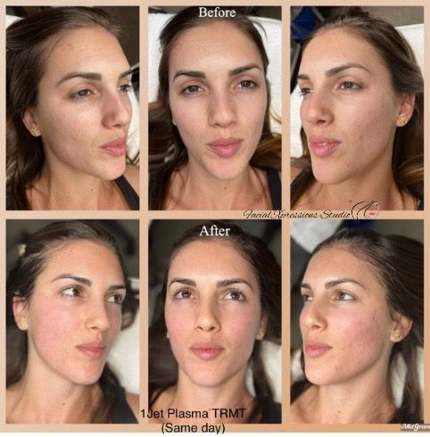 A before and after photo of a woman 's face