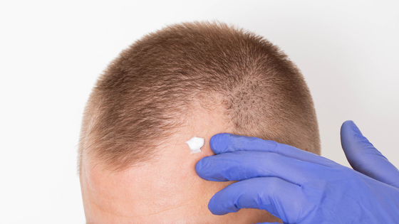 A man is applying a cream to his forehead.