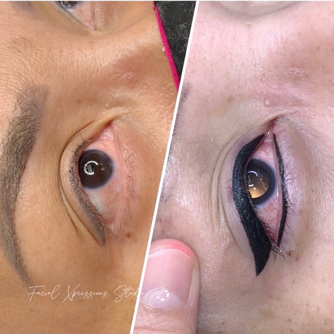 A before and after picture of a woman 's eye