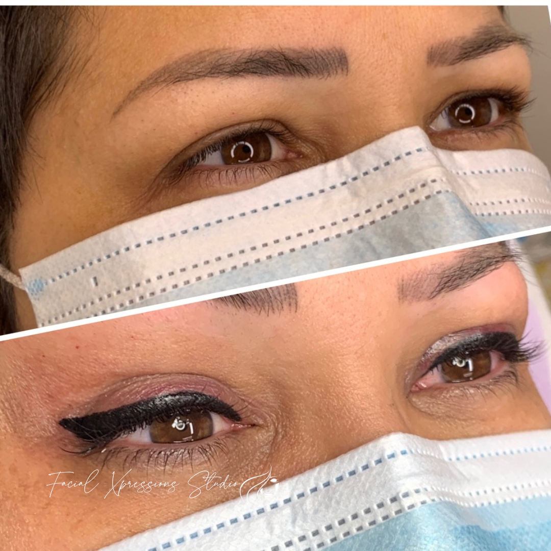A before and after photo of a woman wearing a face mask.