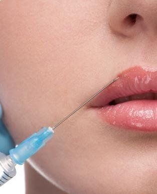 Trattamenti antirughe