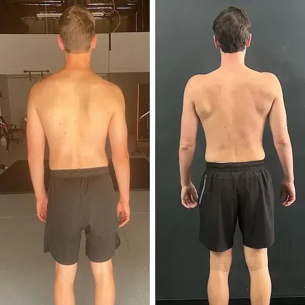 Side-by-side back view of a shirtless person in black shorts, showing posture difference before and after.