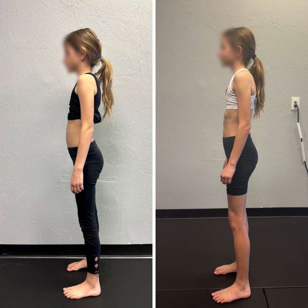 Migraine Improvements - No more migraines and reduced neck pain
