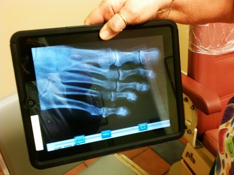 Foot X-ray — Foot surgery in Tampa, FL