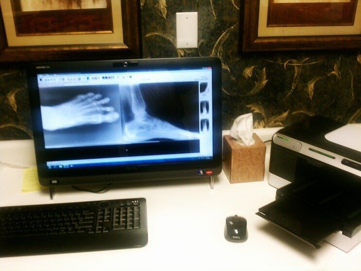 Foot X-ray in the monitor — Pediatric services in Tampa, FL
