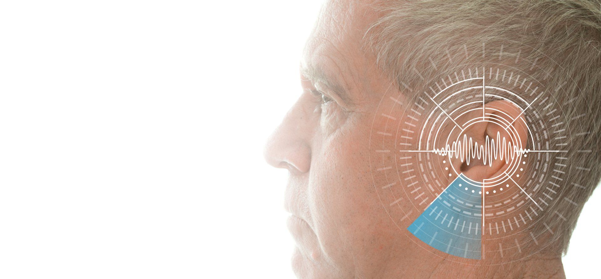 Tinnitus Treatment - Close-up Of A Man Trying To Hear in Summerville, SC