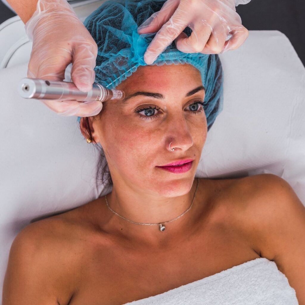 Woman undergoing micro-needling facial treatment, laying on white linens. A gloved hand holds device to skin.