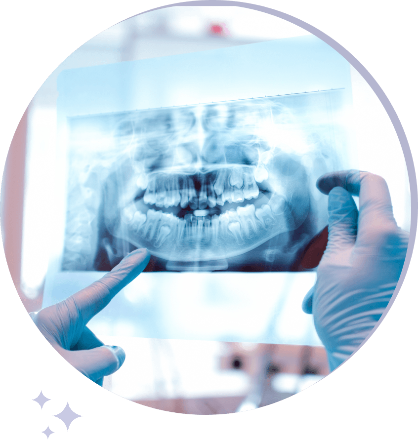 t-scan occlusal analysis