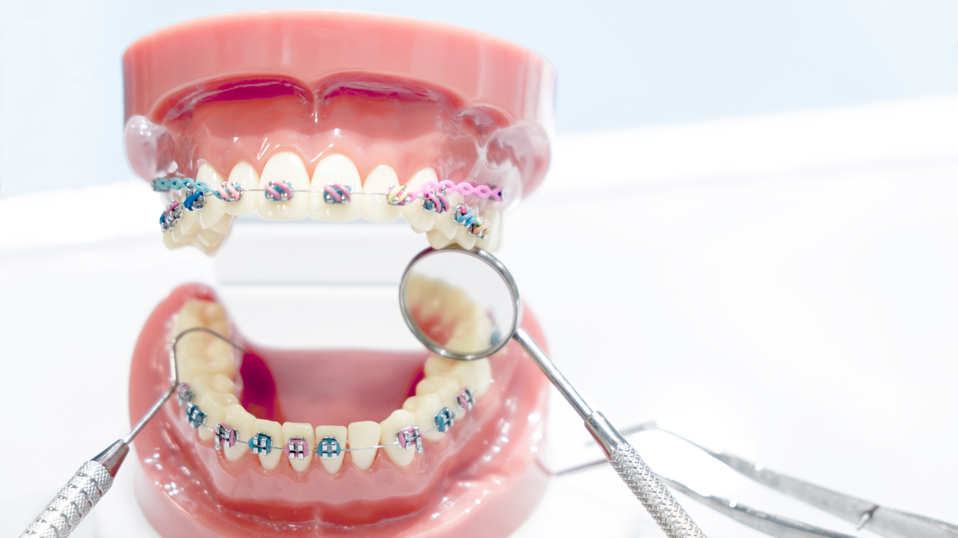 A model of a person 's teeth with braces and dental instruments.