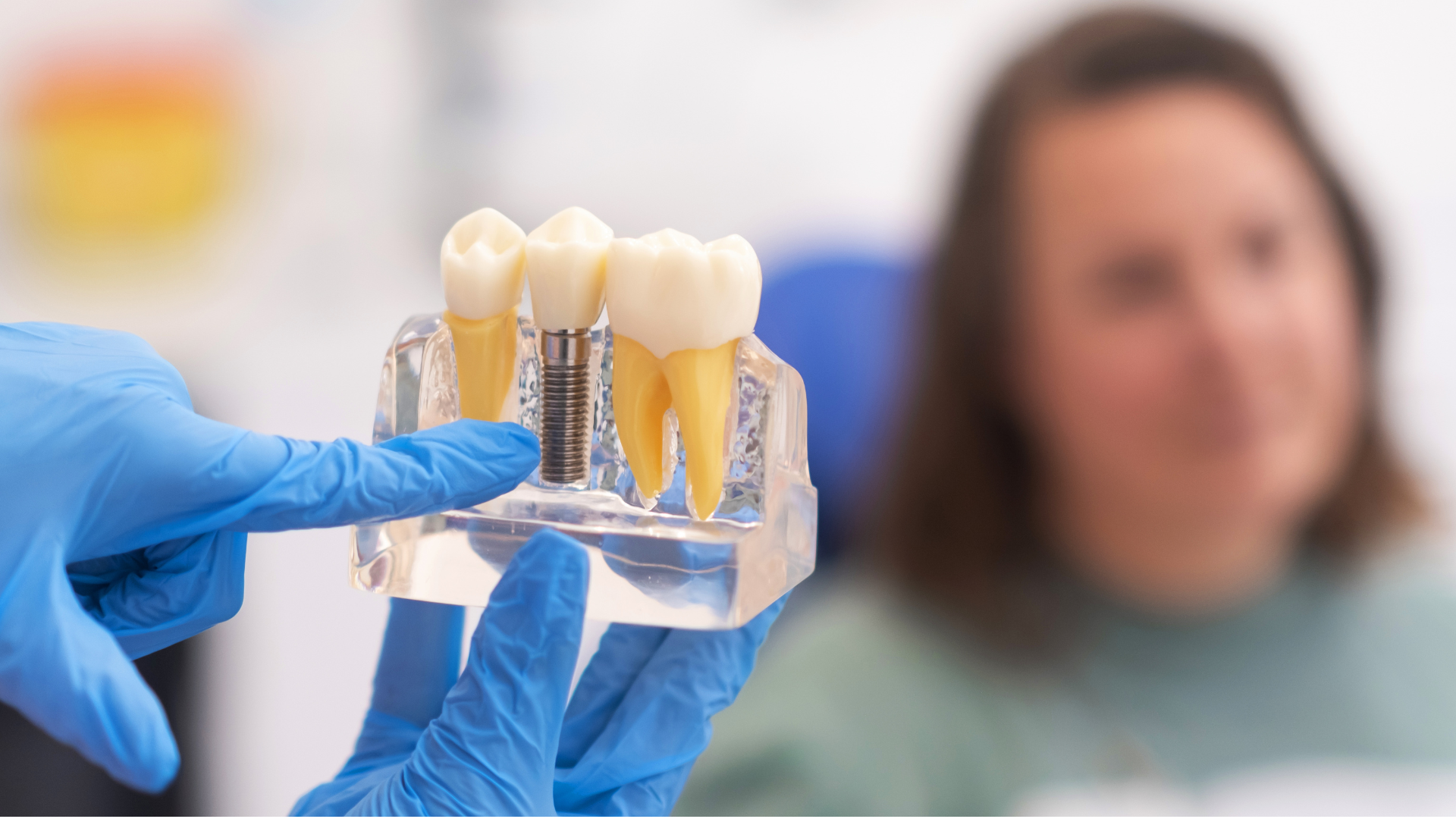 A dentist is holding a model of dental implants in front of a patient.