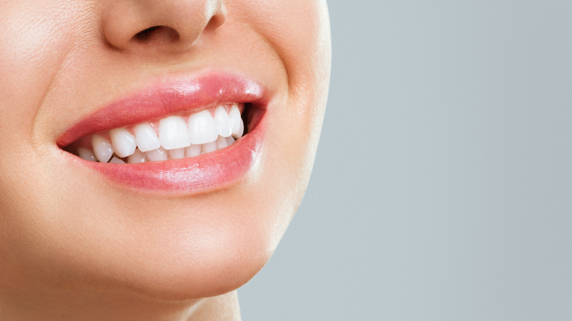 A close up of a woman 's smile with white teeth.