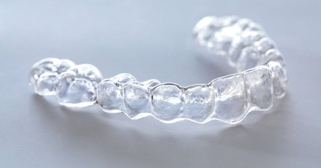 Move and straighten your misaligned teeth to get beautify your smile with  metallic braces. #teeth #invisalign #metallicbrace… | Misaligned teeth,  Teeth, Dental care