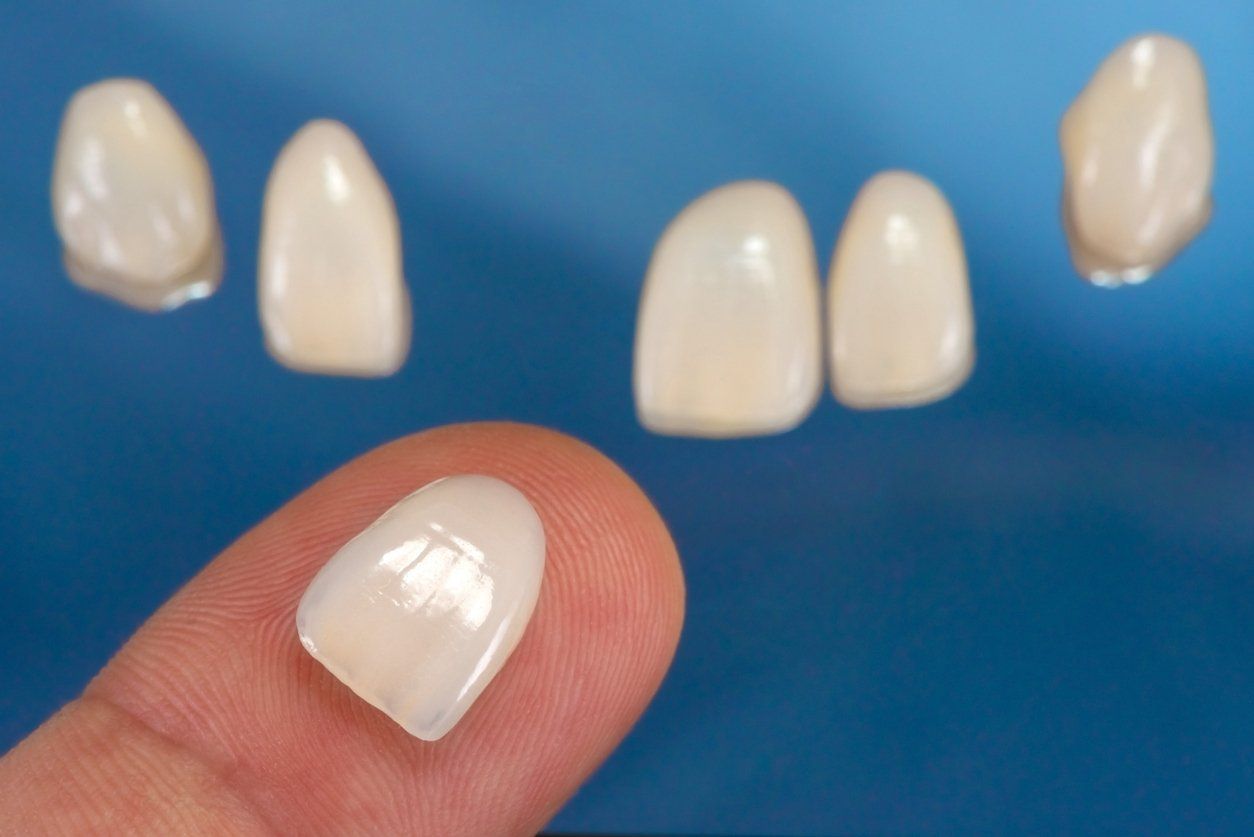 finger holding dental veneers