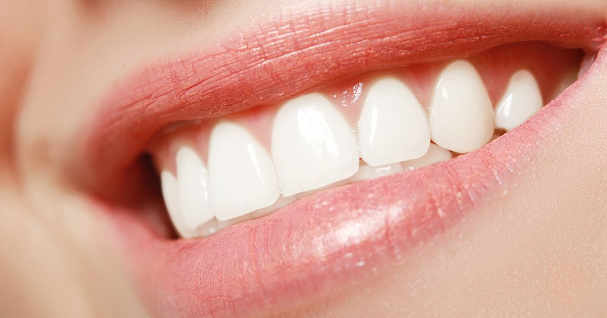 Teeth whitening, Best teeth whitening, Teeth whitening cost, Tooth Discoloration, Types of teeth stain