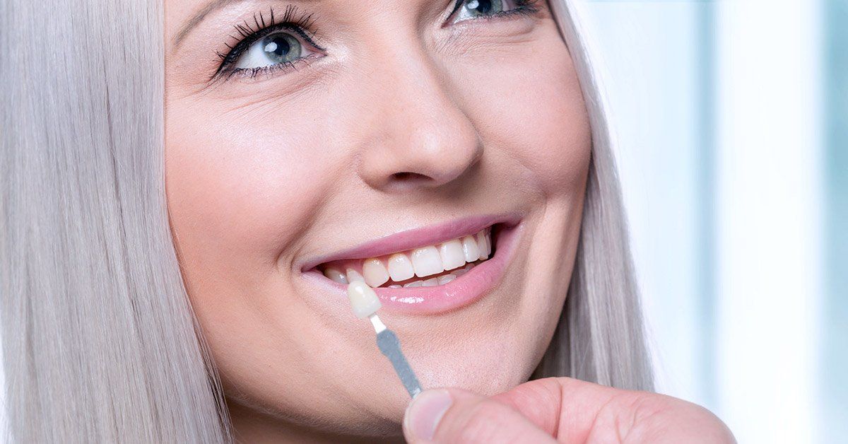 pros and cons of veneers