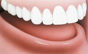 Before Dental Implant — Hudsonville, MI — Hudsonville Family Dentistry